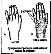 Biology, Class 9, Health and Disease, Types of Diseases, Symptoms